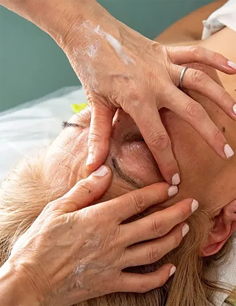 Rejuvenecimiento facial NVF